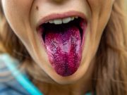 Чи правда, що чистка язику допомагає позбутися від проблем з зубами