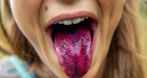 Чи правда, що чистка язику допомагає позбутися від проблем з зубами