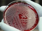 Мікропластик вдалося виявити навіть у крові людини