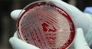 Мікропластик вдалося виявити навіть у крові людини