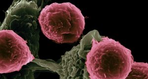 Десять продуктів, що запобігають появі тромбів