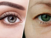 Як прибрати навислу повіку в домашніх умовах