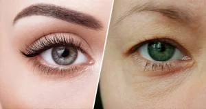 Як прибрати навислу повіку в домашніх умовах
