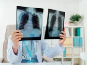 Особливості раку легенів у некурящих людей