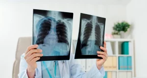 Особливості раку легенів у некурящих людей