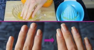 Як прискорити зростання нігтів за допомогою домашніх засобів