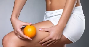 Целюліт на ногах і попі – як позбутися, який засіб кращий?